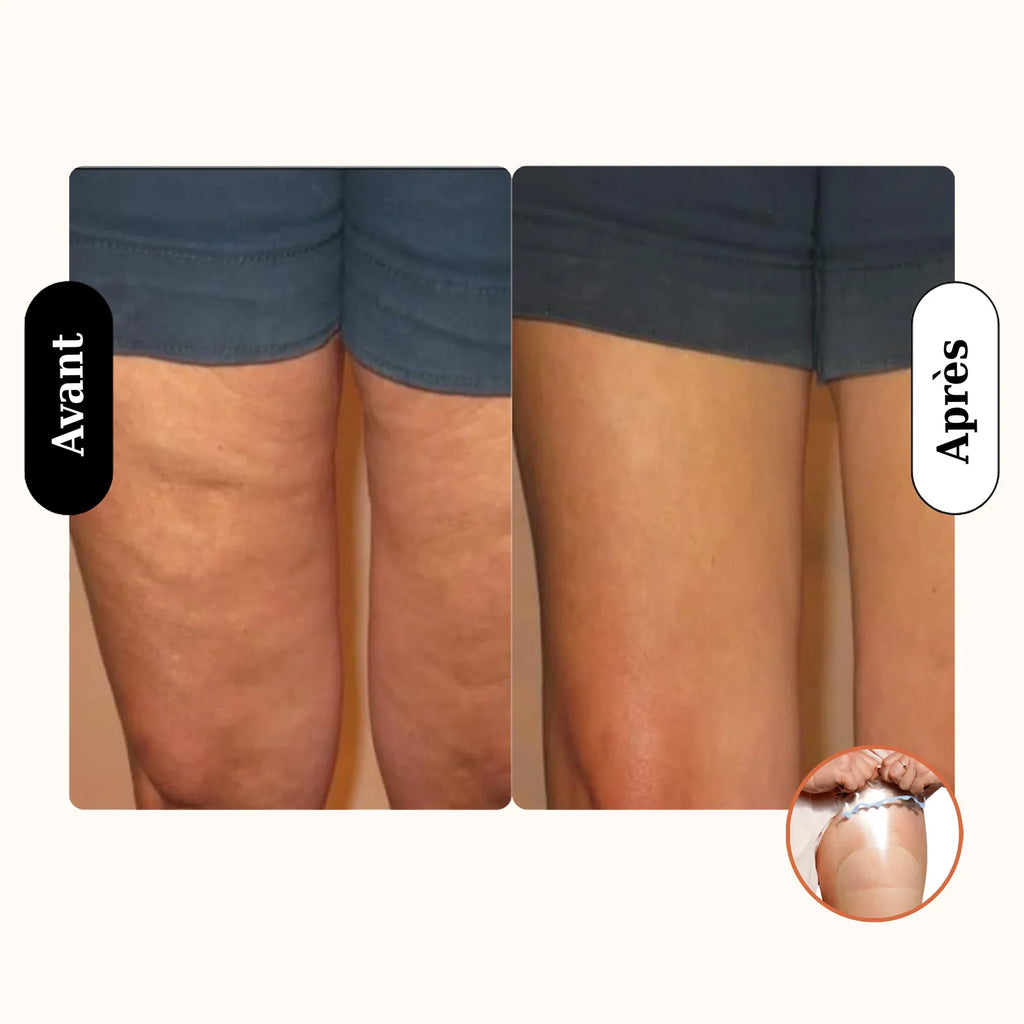 Patch liftants pour le corps SilkWoman™